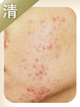 清