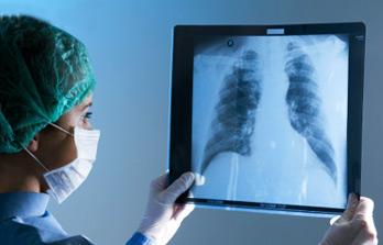 晚期肺癌患者能活多久