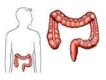 直肠癌与结肠癌有哪些区别？