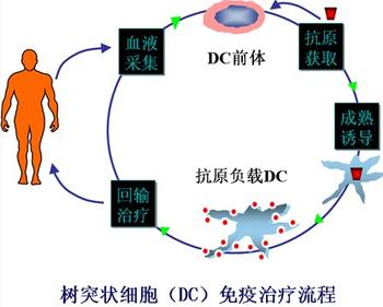 细胞免疫新疗法，“双剑合璧”治肿瘤