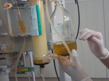 肾囊肿有哪些症状表现呢