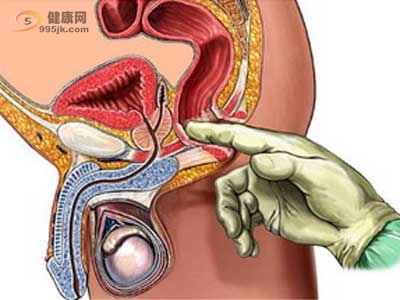 大肠癌的鉴别诊断——大肠癌容易与哪些疾病混淆