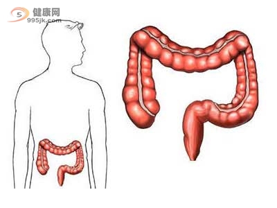 结肠癌不同时期的症状