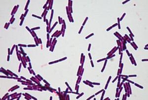 辽宁现炭疽病疫情 食用病畜肉类易发感染炭疽病