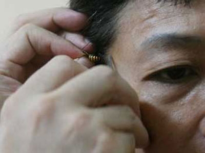 活蜂蜇刺治疗癌症方法解析