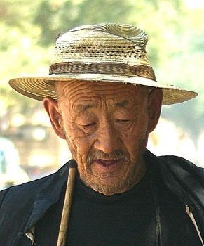 老年人最易出现的膀胱癌症状
