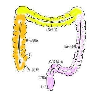 直肠癌是由什么原因引起的