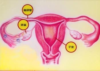 卵巢癌早期有什么症状表现