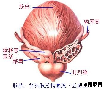 膀胱癌的病因