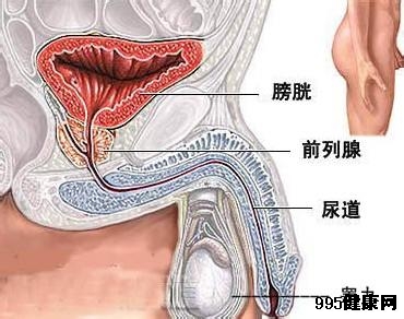 膀胱癌的早期症状