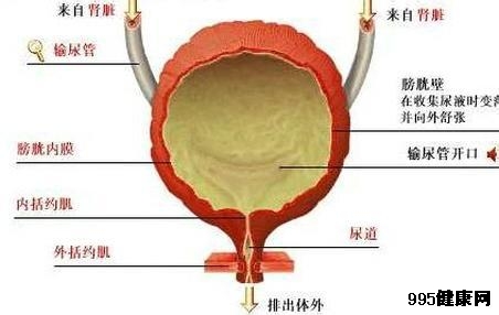 膀胱炎概述