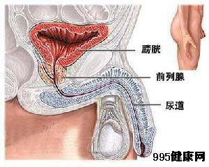 附睾炎概述