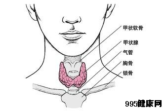 甲状腺结节自己会好吗?