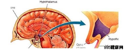 下丘脑疾病概述