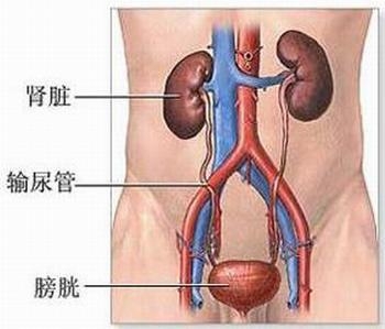 膀胱癌最好治疗方法