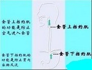食管贲门失弛缓症