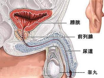 膀胱癌术后如何保养