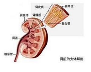 糖尿病肾病的诱因