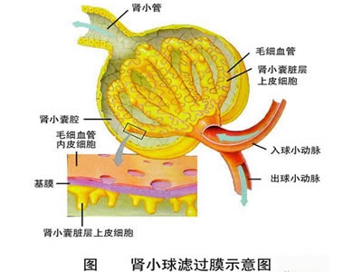 怎样治疗急性肾小球肾炎?