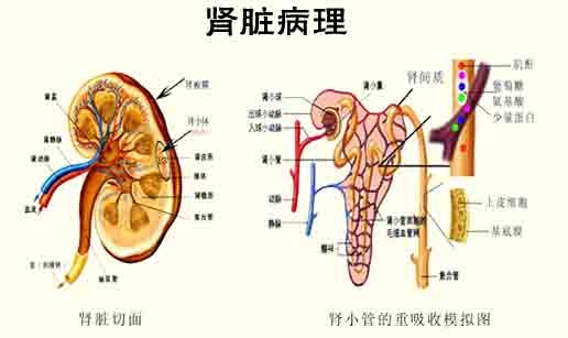 引起隐匿性肾炎的病因有哪些