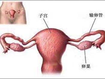 女人什么情况下易患卵巢癌