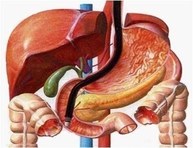 胰腺癌鉴别诊断方法有哪些