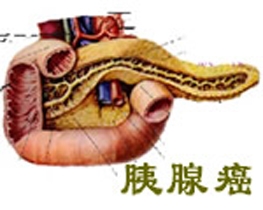 胰腺癌的症状及治疗