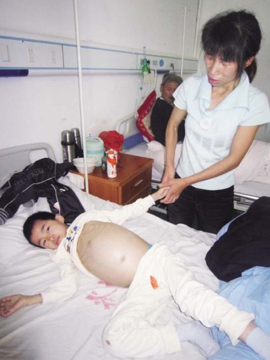 肝癌大量腹水护理