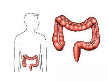 大肠癌的早期症状