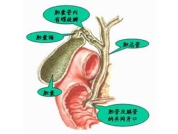 慢性胆囊炎能治好吗