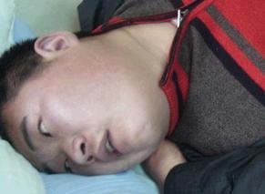常见癫痫病有哪几种 