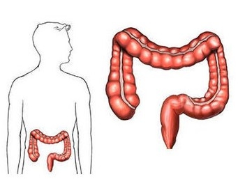 3招拆穿大肠癌的“伪装”