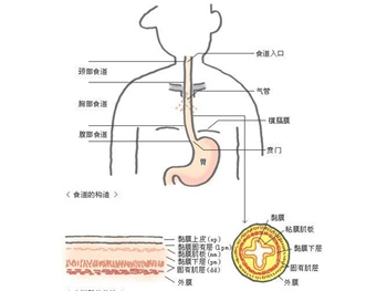 食道癌有哪些癌前表现