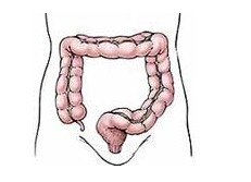 大肠癌的症状及治疗