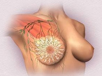 乳腺癌的预防方法