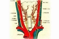 甲状腺癌改良根治术有什么?