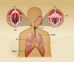 喉癌早期是什么症状?