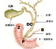 胆管癌的概述