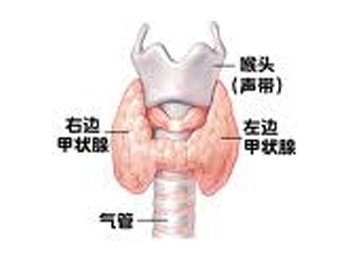 甲状腺癌很容易与哪些疾病搞混