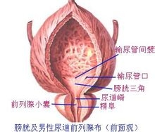 膀胱鳞状癌细胞的鉴别诊断