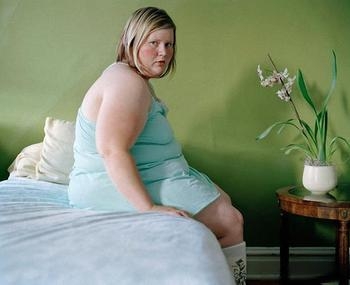 为什么肥胖女性容易发生胆管癌