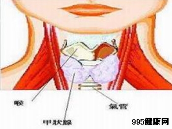 幼年型甲状腺癌你了解多少