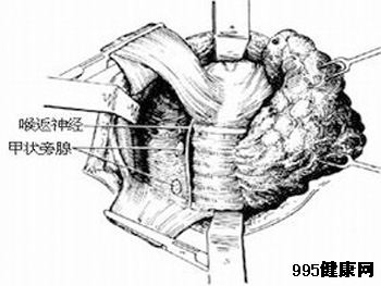 甲状腺癌的常识性知识