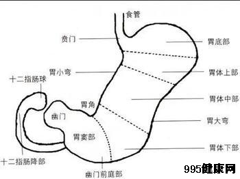 治疗胃泌素瘤的预后情况