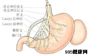 胃泌素瘤概述