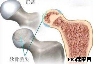 治疗恶性骨肿瘤的偏方有什么