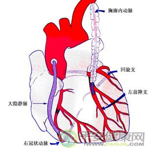 患冠心病通常会出现哪些症状