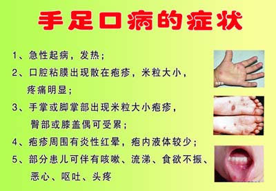 手足口发病比去年翻倍，专家谈预防全攻略