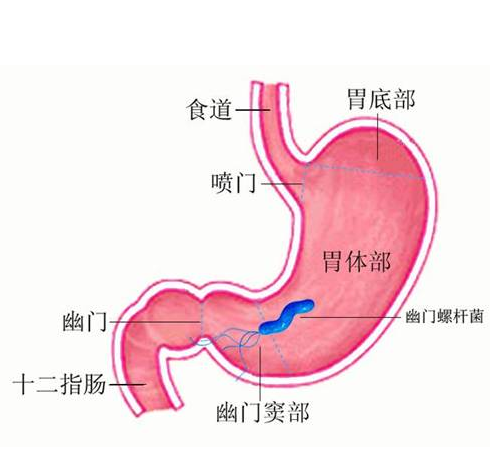 防治胃癌的常见验方有哪些？