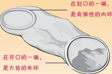 女用安全套使用方法